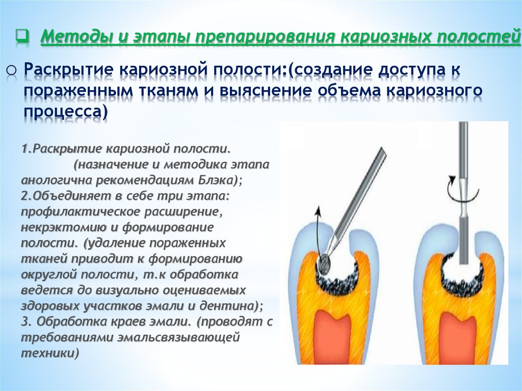 Теория возникновения кариеса презентация