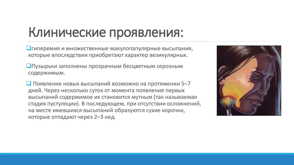 Невралгия отзывы. Невралгия тройничного нерва клинические рекомендации. Поражении тройничного нерва классификация. Постгерпетическая невралгия нервы.