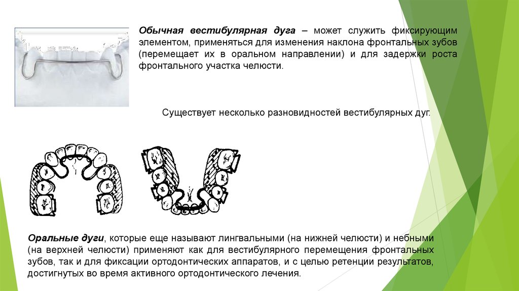 Презентация ортодонтические дуги