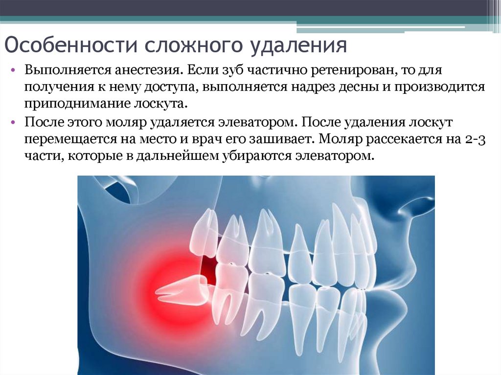 Осложнения после удаления