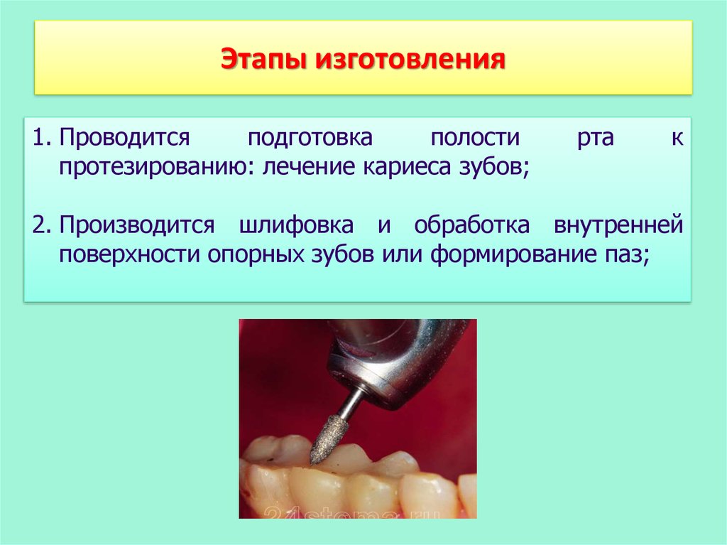 Подготовка полости рта к протезированию. Этапы изготовления протеза. Мостовидные протезы презентация. Подготовка к протезированию зубов.