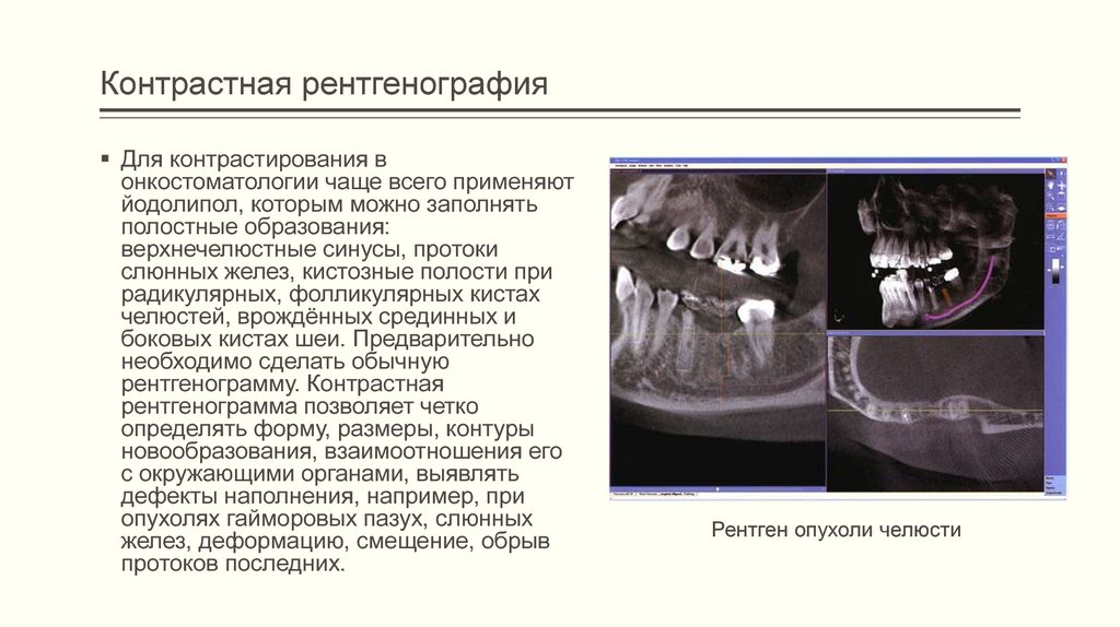 Возрастные особенности изображения зубов и челюстей в норме на рентгенограммах