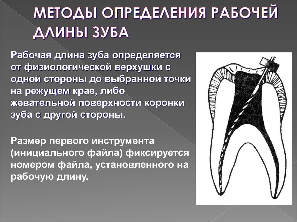 Методы лечения зубов с проблемными корневыми каналами презентация