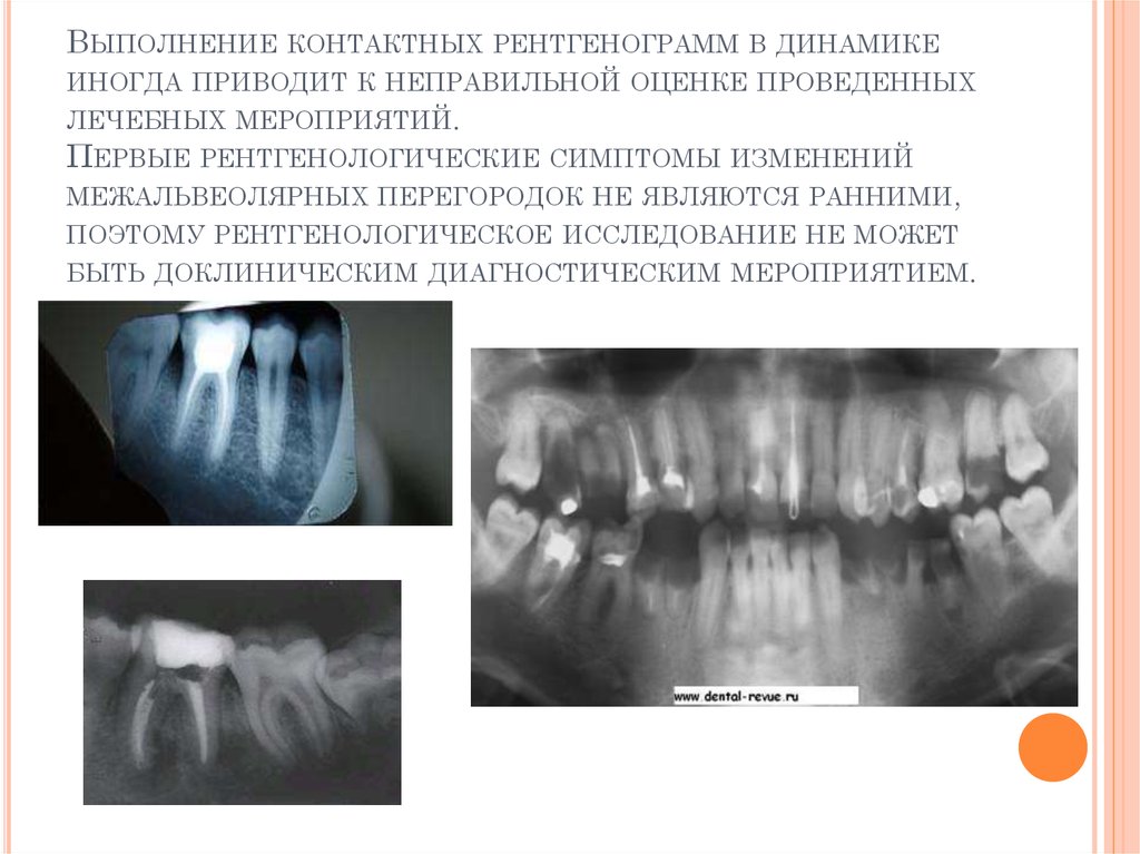 Схема описания оптг