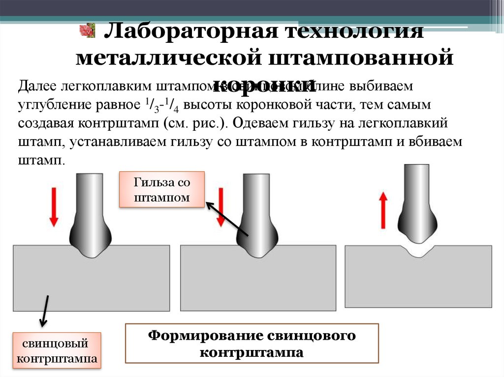 Препарирование под штампованную коронку схема