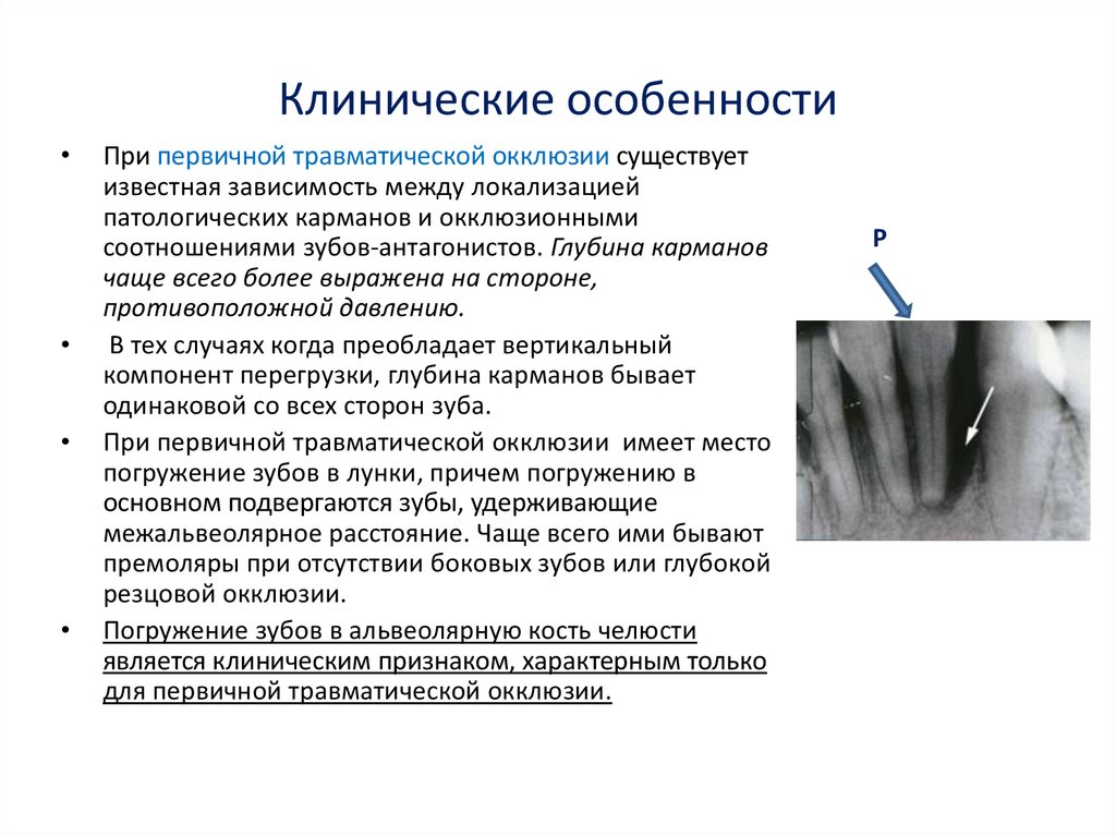 Диагностика пародонта. Генерализованный пародонтит этиология и патогенез. Ятрогенный пародонтит. Хронический пародонтит классификация. Пародонтит классификация этиология патогенез.