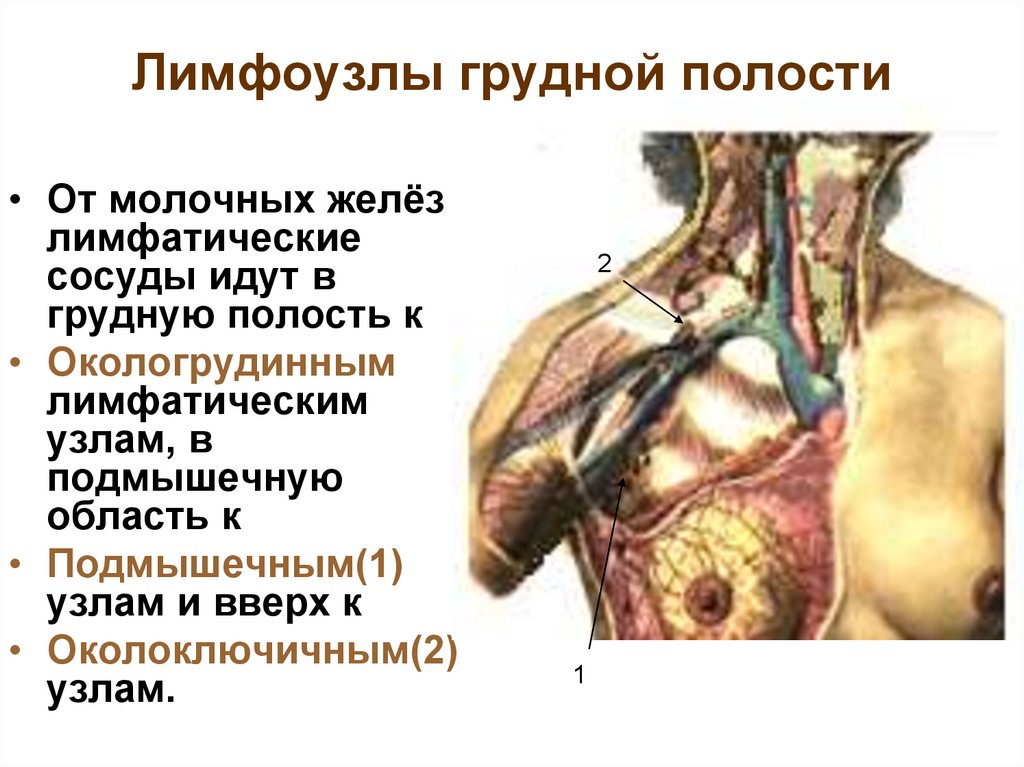 Узлы молочных желез. Межреберные лимфоузлы расположение. Лимфатические узлы грудной стенки. Лимфатические узлы грудной полости. Лимфоузлы грудной полости.