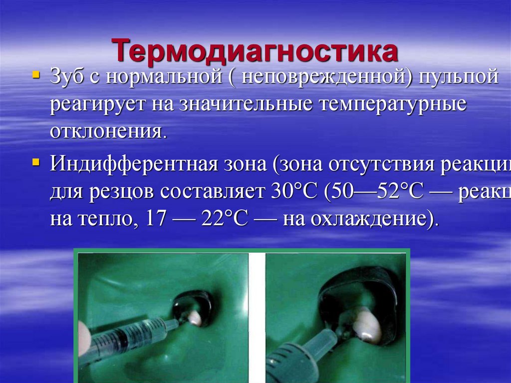 Полость применение. Термодиагностика в стоматологии. Методика термодиагностики. Терможиашностика зцбов. Метод термометрии в стоматологии.