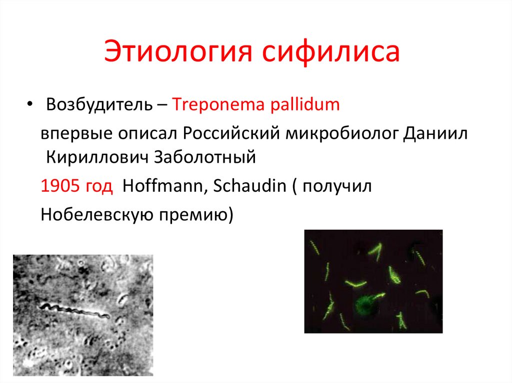 Признаки Сифилиса Во Рту Фото