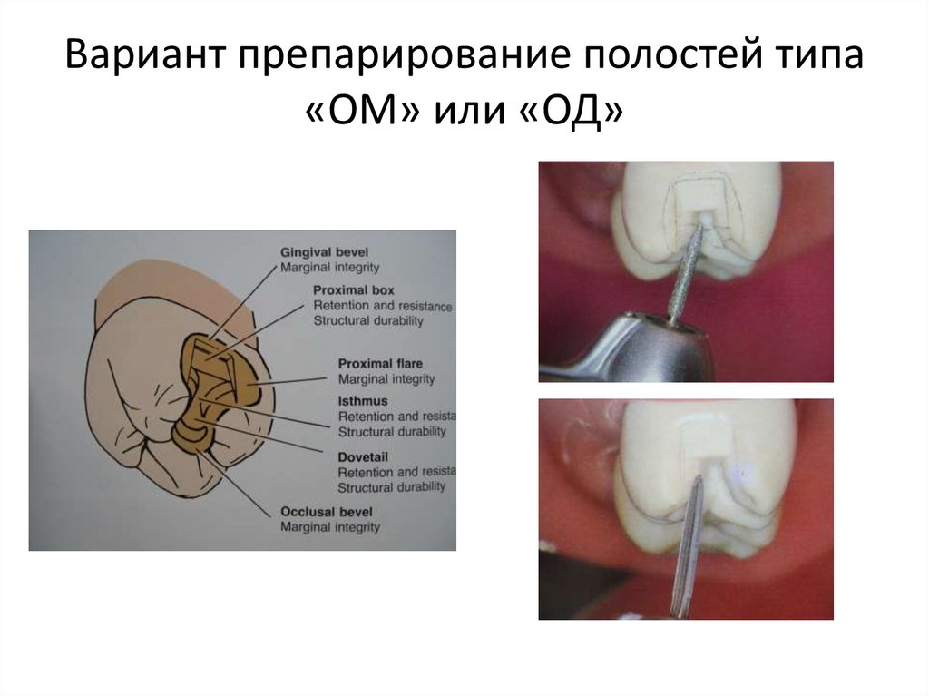 Типы полостей