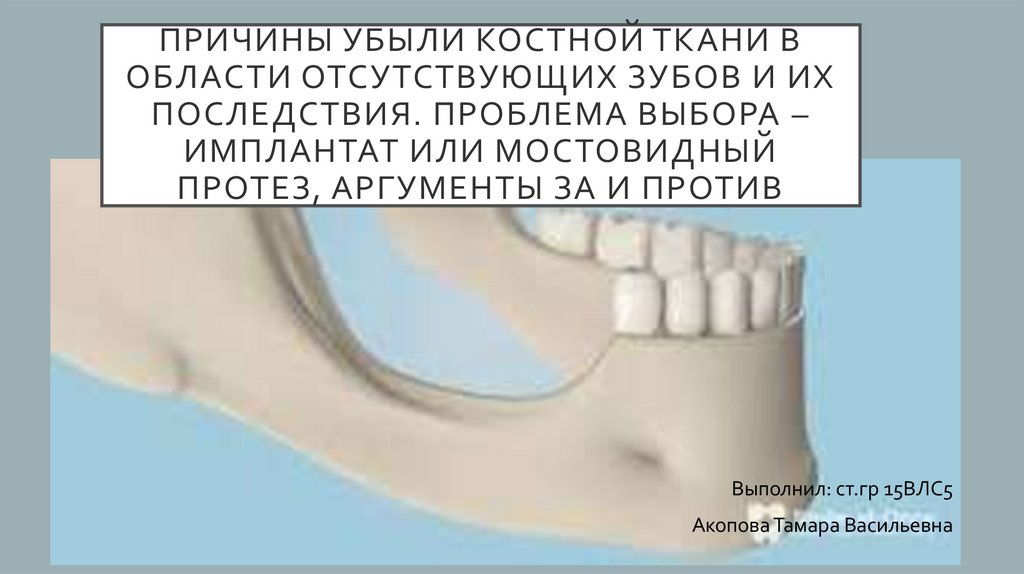 Костная ткань челюсти. Убыль костной ткани зуба. Убыль костной ткани челюсти. Убывание костной ткани зубов что это такое. Причины убыли костной ткани.