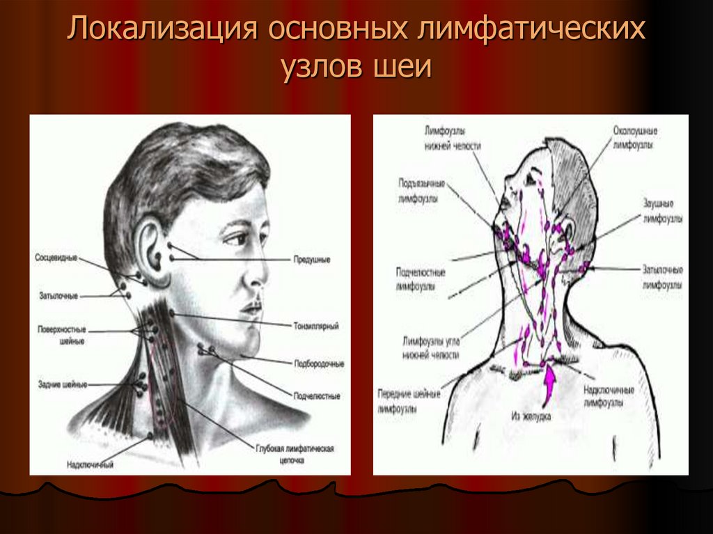 Лимфоузлы на шее где находятся схема