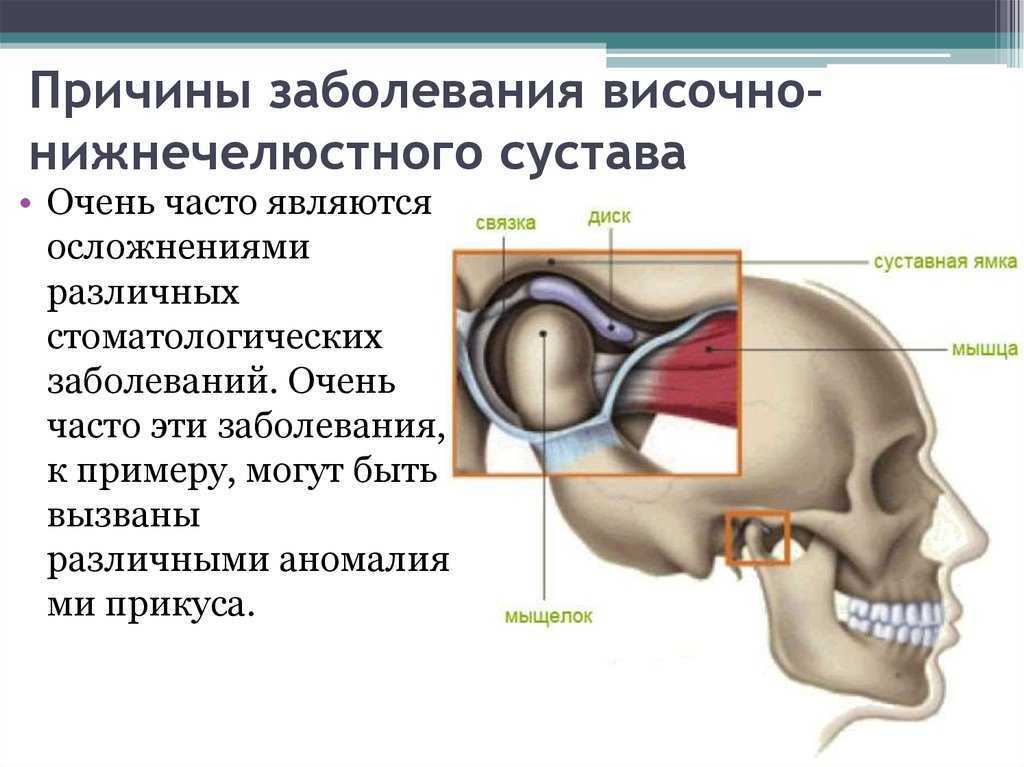 Височно нижнечелюстной сустав презентация