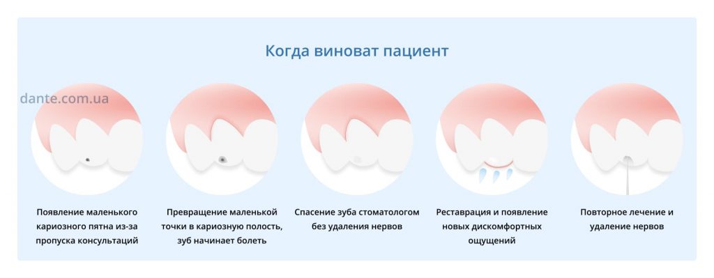 Зуб Шатается Фото