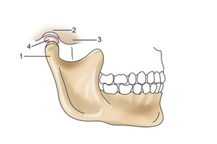Мыщелки челюсти. Анатомия сустава ВНЧС. Нижнечелюстная ямка ВНЧС. ВНЧС суставная головка нижней челюсти.