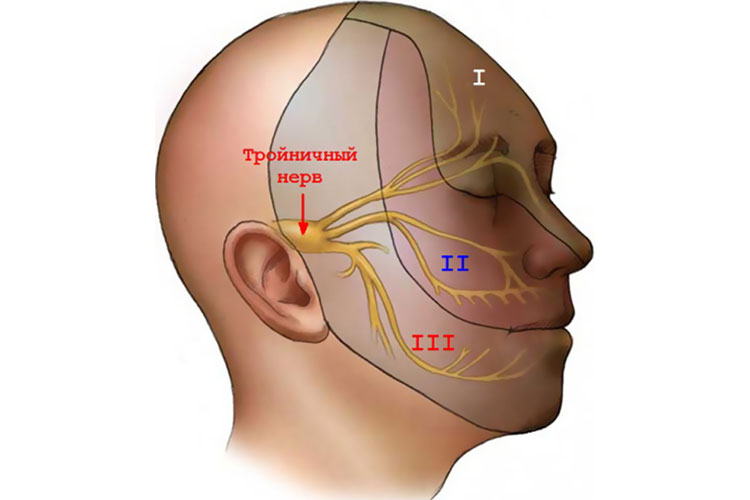 Защемление тройничного нерва симптомы
