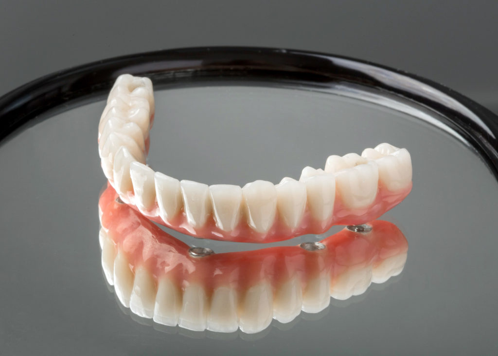 Образцы зубных протезов фото