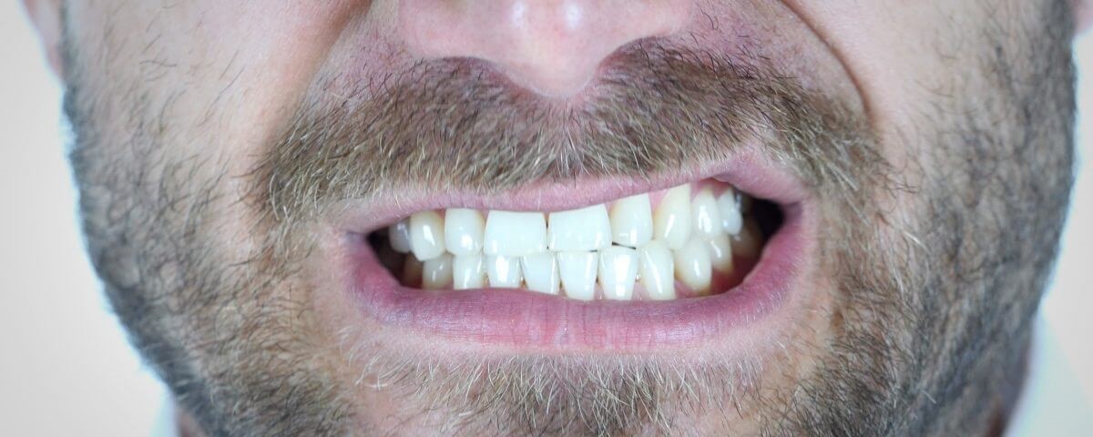 Скрежет зубами у взрослого причины. Стискиваю зубы во сне причины. Заболевание многозубов.