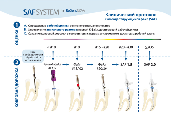 Зубные инструкция по применению. Saf эндодонтия. Система Саф эндодонтия. Saf система в эндодонтии. Саф для обработки корневых каналов.