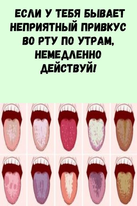 Металлический вкус во рту у женщин причины. Неприятный привкус. Металлический вкус на языке. Привееус во рту.