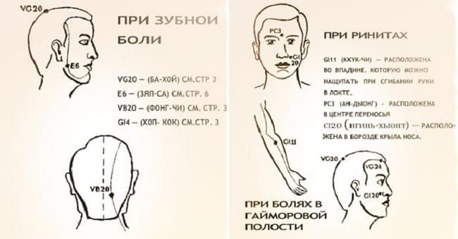 Точки на теле от зубной боли показать картинки