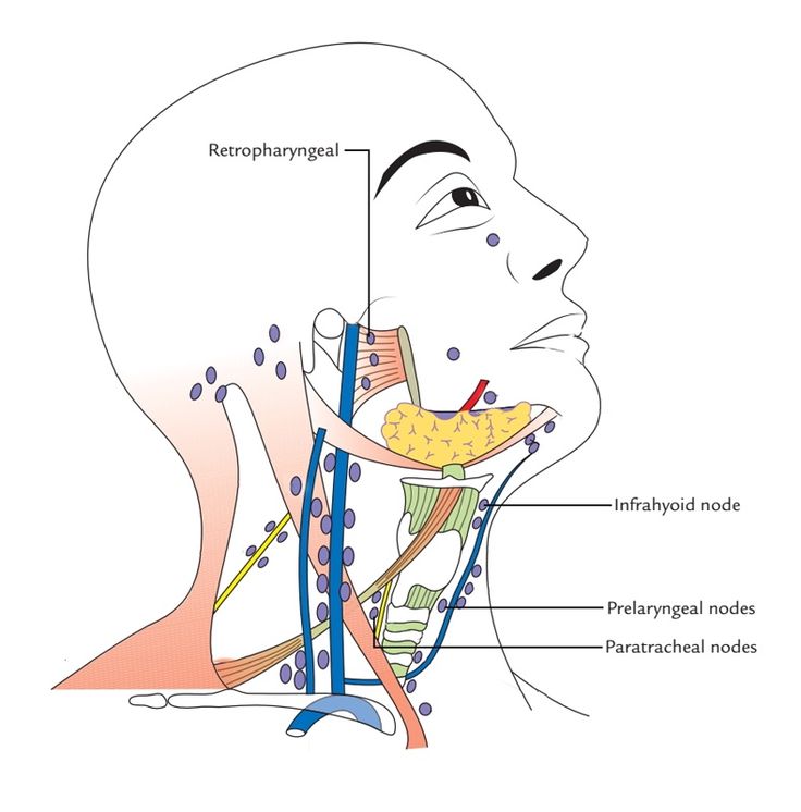 Лимфоузлы под челюстью схема расположения
