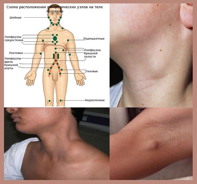 Лимфоузлы под мышками расположение схема у мужчин картинки фото и описание