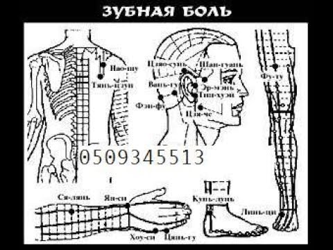 Точки на теле от зубной боли показать картинки