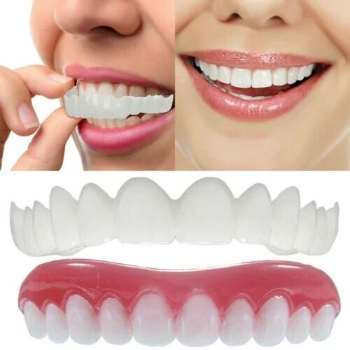 Виниры в аптеках. Виниры Snap on smile. Виниры-элайнеры Snap-on smile. Cъемные виниры perfect smile Veneer (Snap on smile). Съемные виниры Snap-on smile (490 руб.).