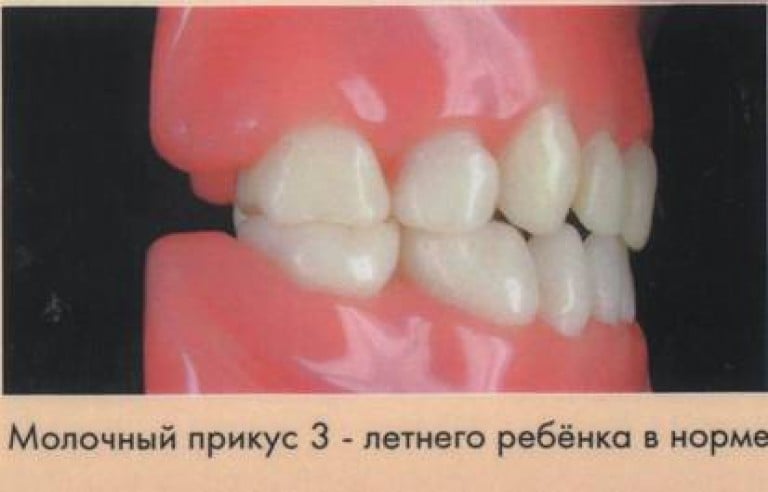 Временная окклюзия. Формирующийся временный прикус норма. Прикус молочных зубов формируется к.