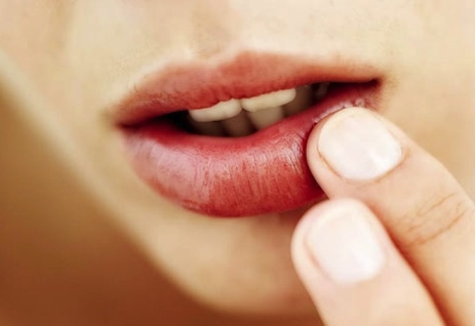 Прыщ во рту на губе: Пузырек на внутренней стороне губы, на слизистой .