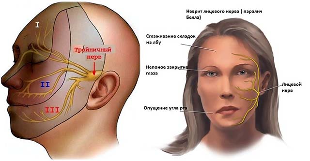 Лицевой нерв справа. Воспаление тройничного лицевого нерва. Тройничный лицевой нерв.