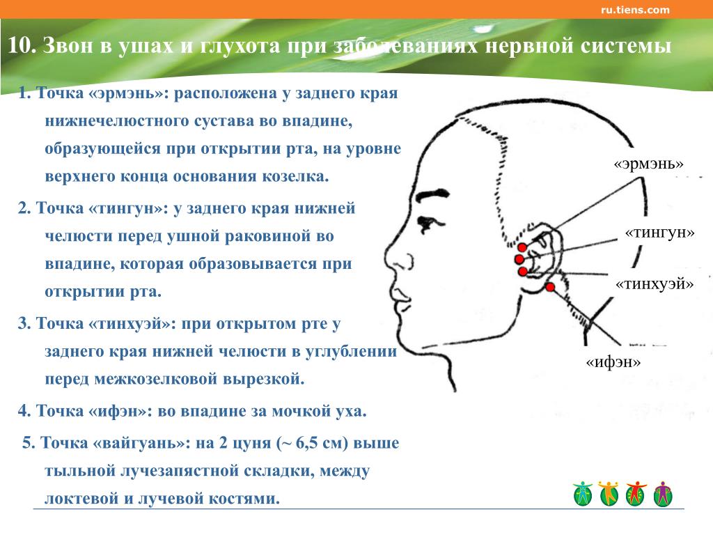 Корнилова схема волосы