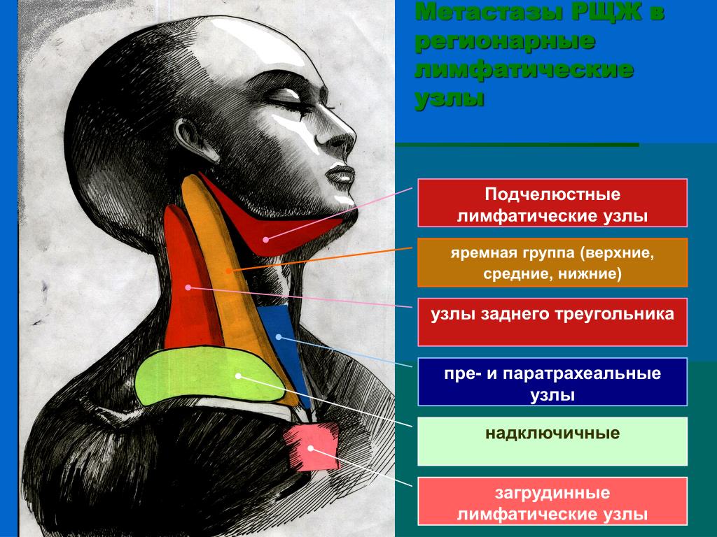 Подчелюстные лимфоузлы на шее расположение схема у взрослых