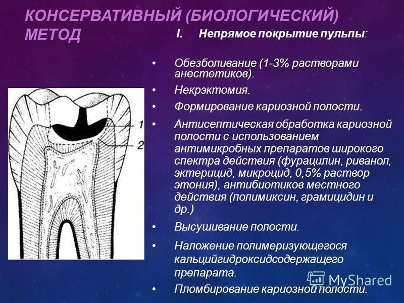 Стадии пульпита