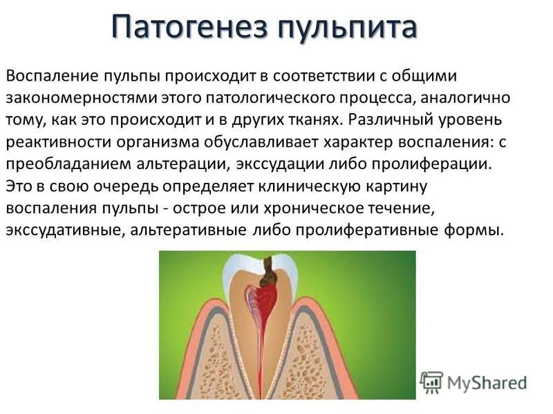 Этиология патогенез пульпита презентация