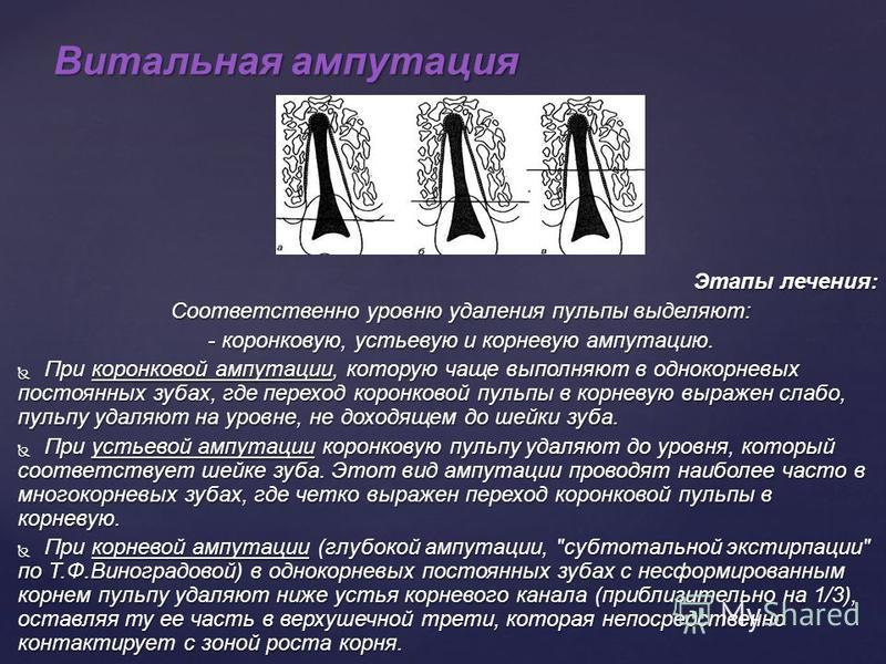 Несформированное изображение это