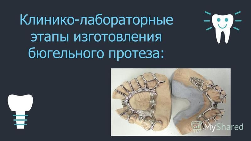 Клинико лабораторные этапы изготовления протезов
