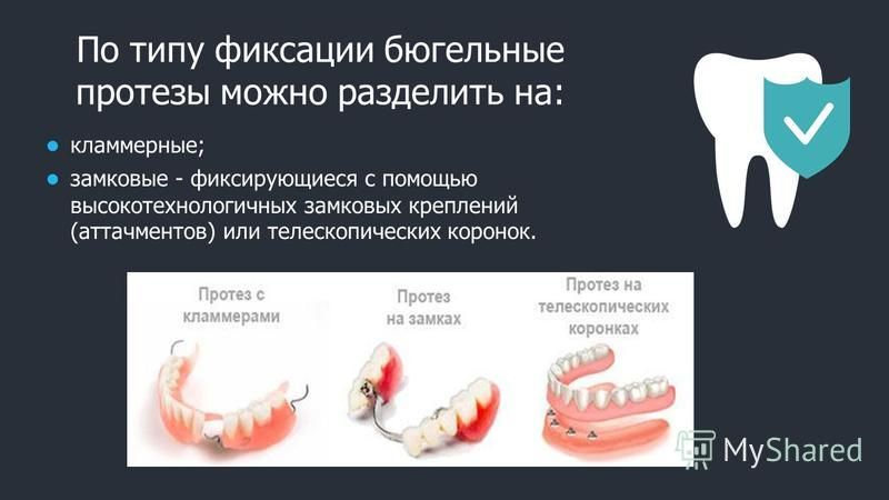 Методы фиксации и стабилизации съемных протезов при полном отсутствии зубов презентация