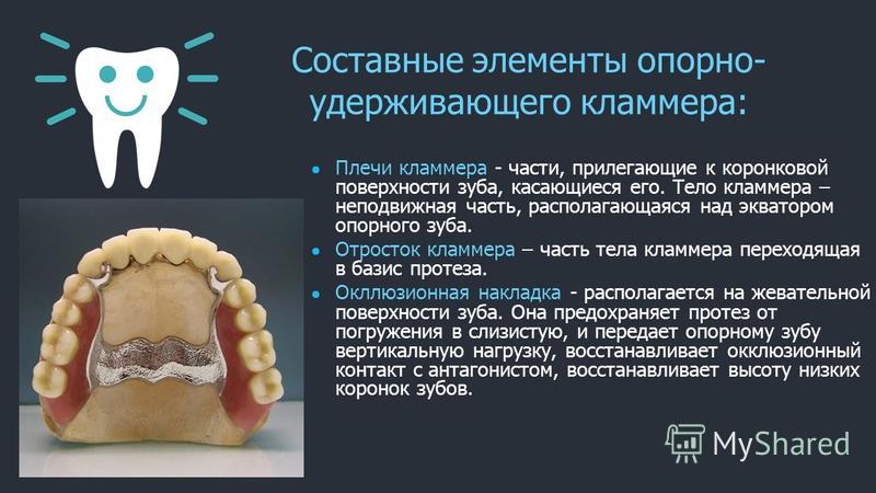 Шинирующие бюгельные протезы презентация