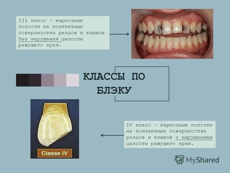 Классификация полостей