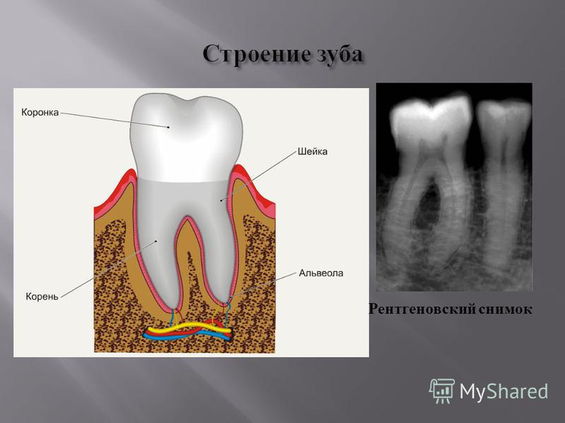 Строение зуба и языка. Строение зуба 3 класс.