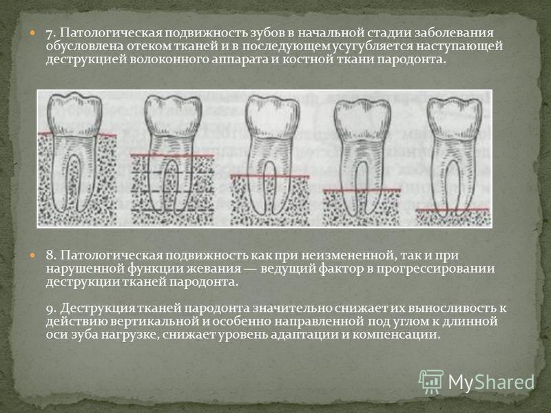 Рентгенологическая картина костной ткани челюстей при пародонтите тяжелой степени