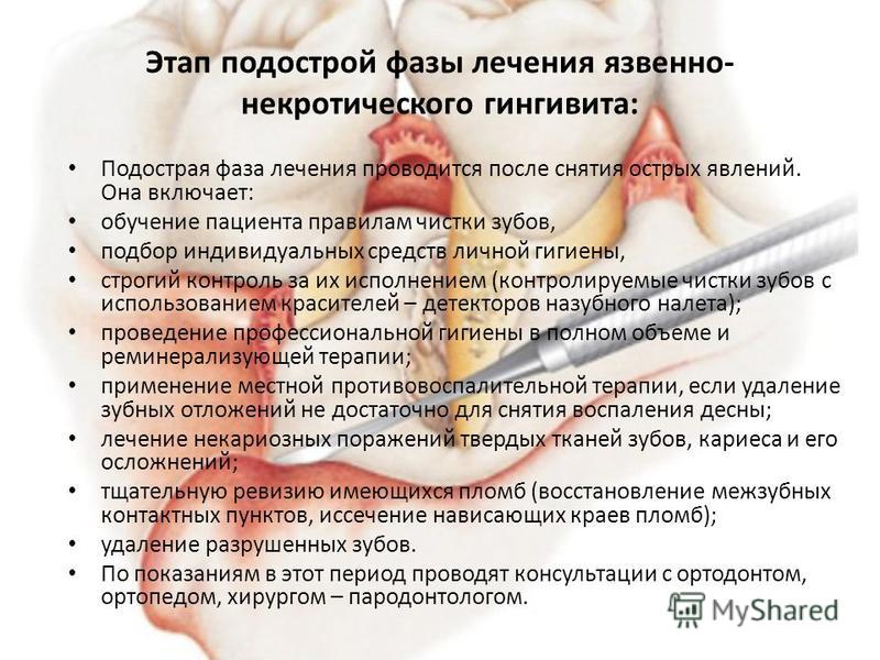 План лечения гингивитов