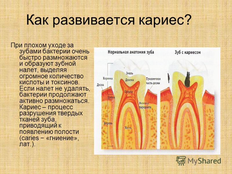 Кариес причины. Пищеварение в ротовой полости зубы. Пищеварение в ротовой полости строение зубов. Пищеварение в ротовой полости строение зуба.