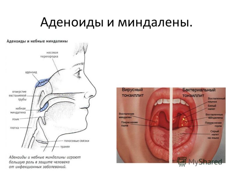 Миндалины схема расположение