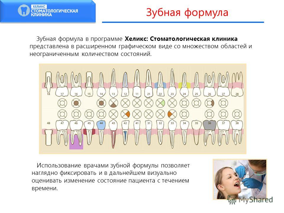 Зубная формула это. Зубная формула стоматология справка. Зубная формула зубы. Зубная формула обозначения. Зубная формула постоянных зубов.