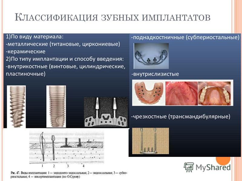 Профилактика и лечение осложнений стоматологической имплантации презентация