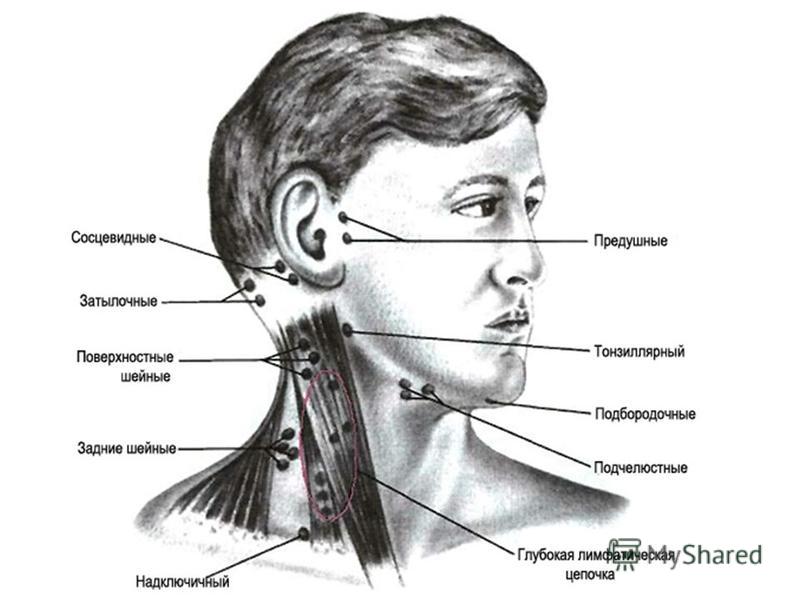 Лимфоузлы на челюсти расположение схема рисунок