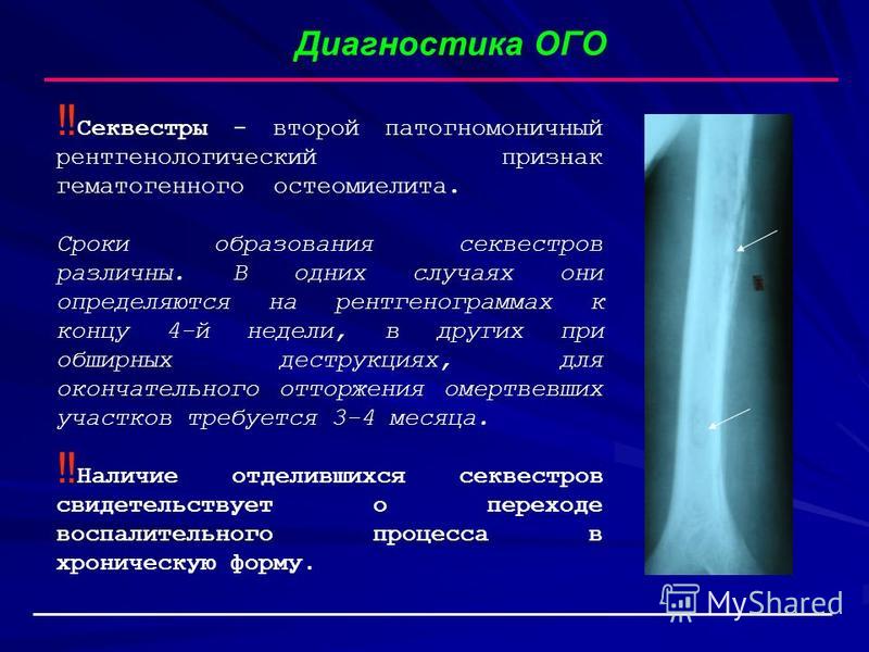 Гематогенный остеомиелит это воспаление тест